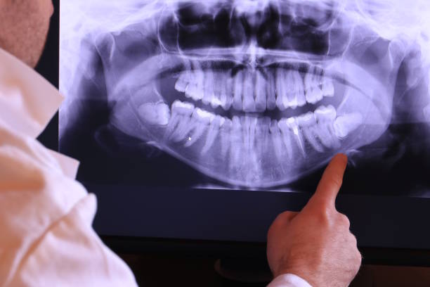 Best Emergency Tooth Extraction in Montrose, PA